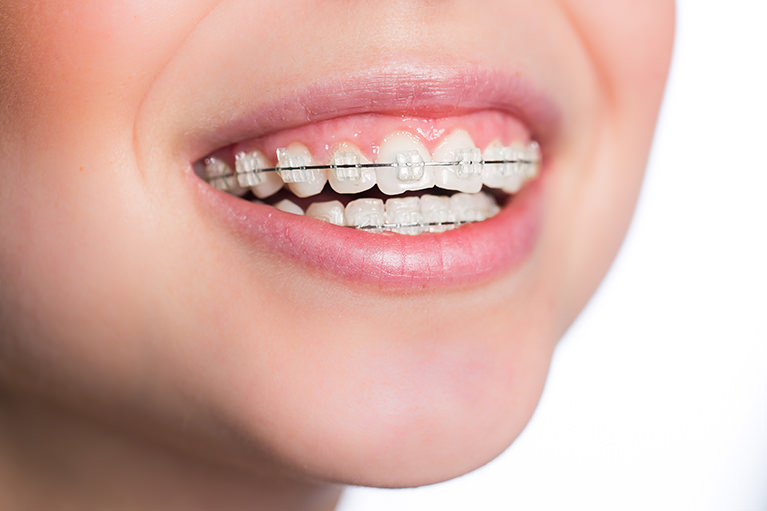矯正歯科とのコミュニケーションで、総合的な歯の治療を行います